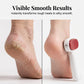 ✨📢LAST DAY SALE: Only ￡5.99!!!🔥Double-Sided Foot Scraper for Callus Removal