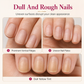 🥳2026 HOT SALE🥳💞50K+ SOLD!🍃 50% OFF!💅Smooth Nail Ridges Instantly! Natural Ridge Filler